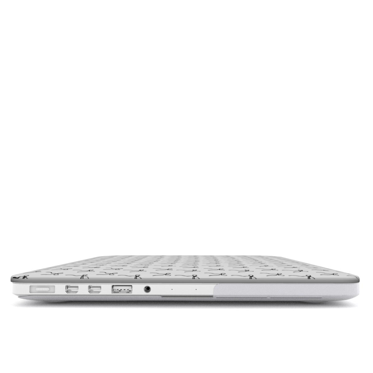 Understated - Ultra Slim MacBook Case