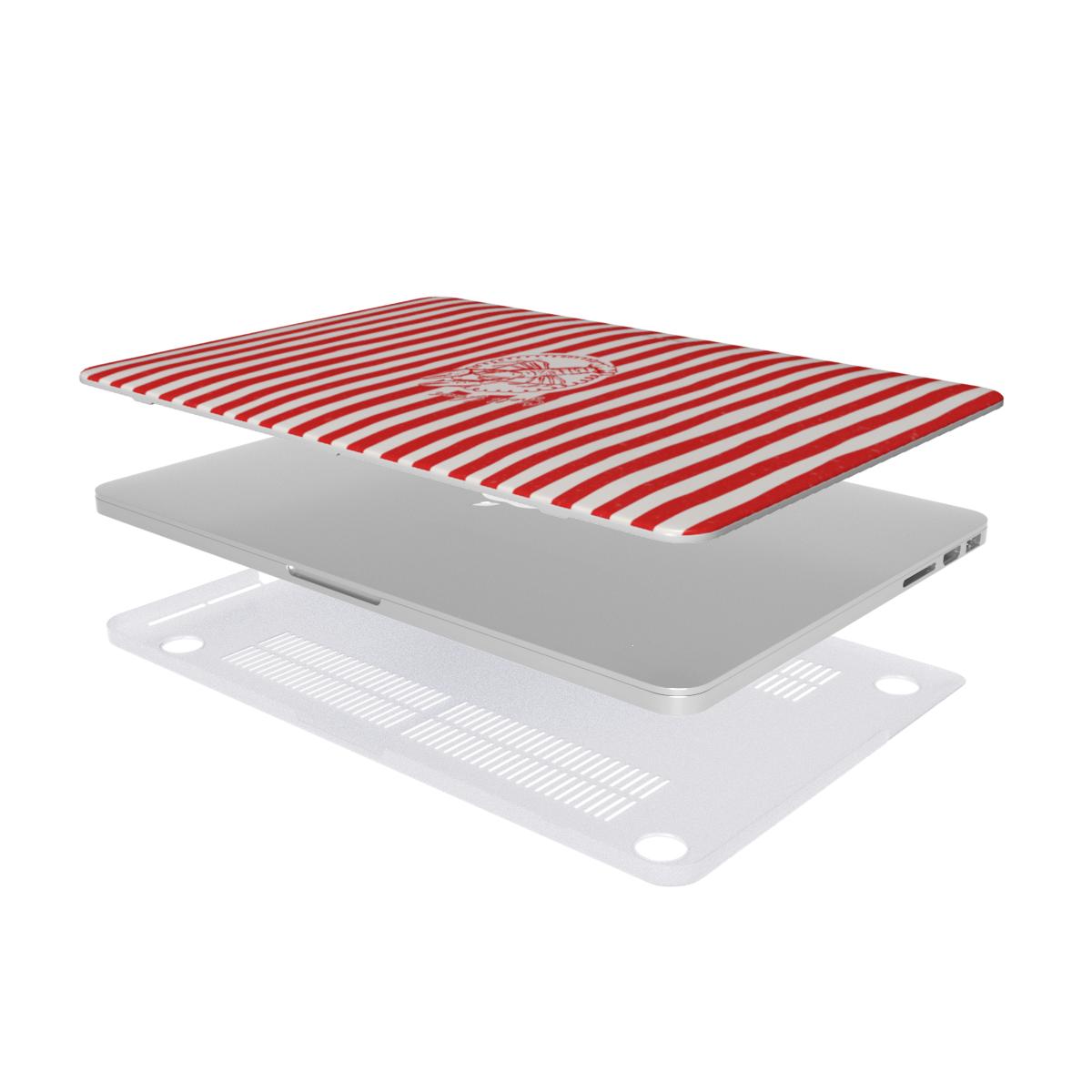 Shell Yeah - Ultra Slim MacBook Case