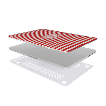 Shell Yeah - Ultra Slim MacBook Case
