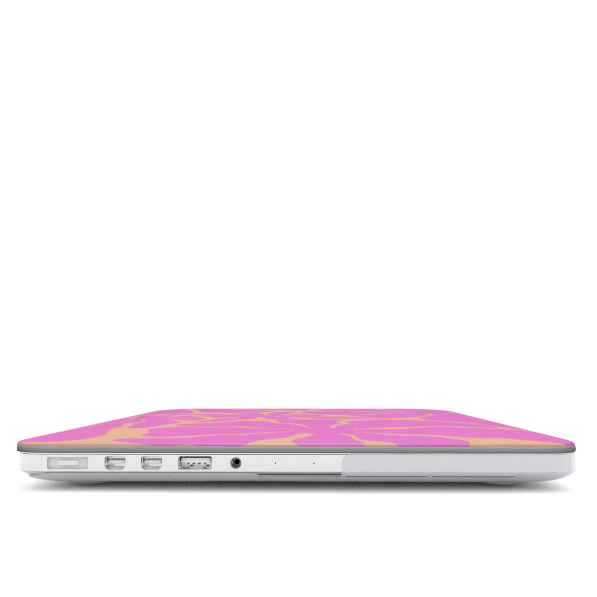 Summertime - Ultra Slim MacBook Case