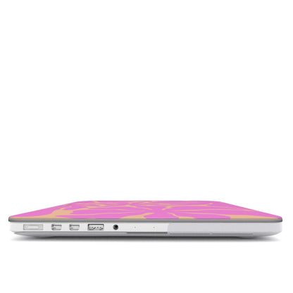 Summertime - Ultra Slim MacBook Case