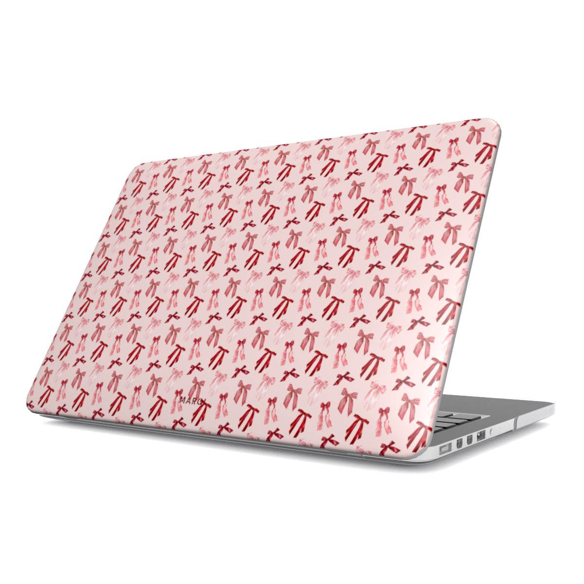 Girly Girl - Ultra Slim MacBook Case