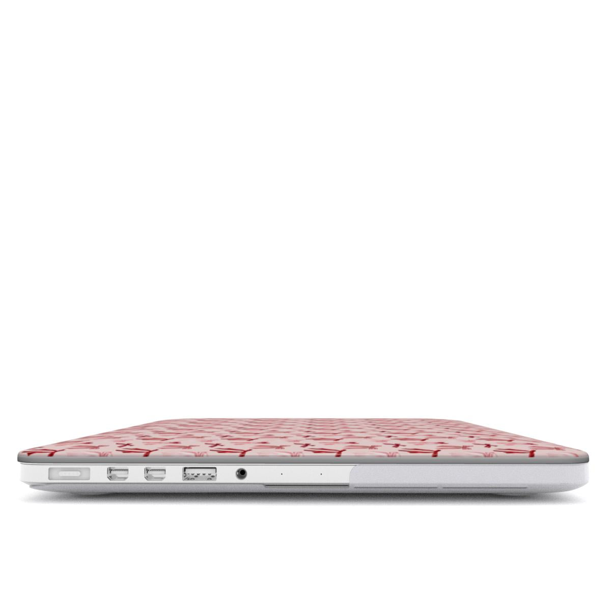 Girly Girl - Ultra Slim MacBook Case