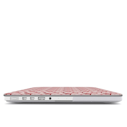 Girly Girl - Ultra Slim MacBook Case